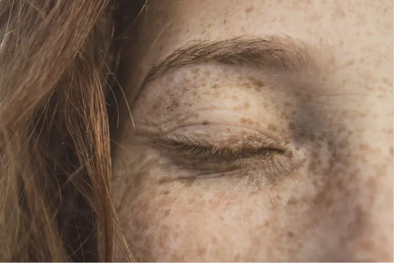 Nahaufnahme des Gesichts einer Person mit geschlossenen Augen, Sommersprossen und rötlichem Haar.